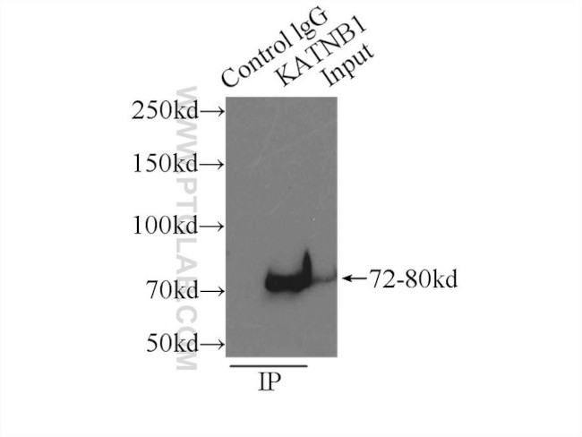 KATNB1 Antibody in Immunoprecipitation (IP)