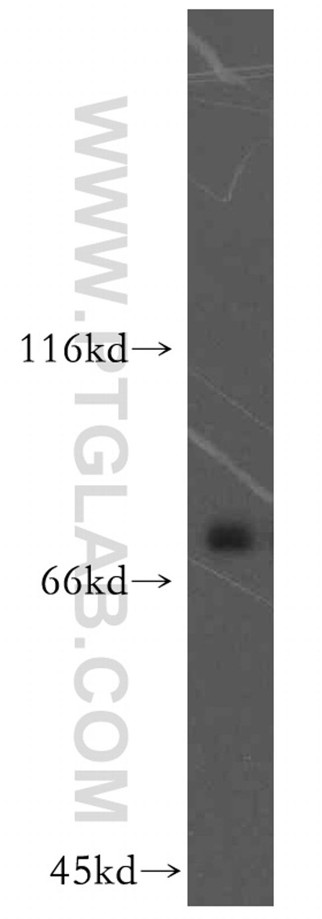 KATNB1 Antibody in Western Blot (WB)