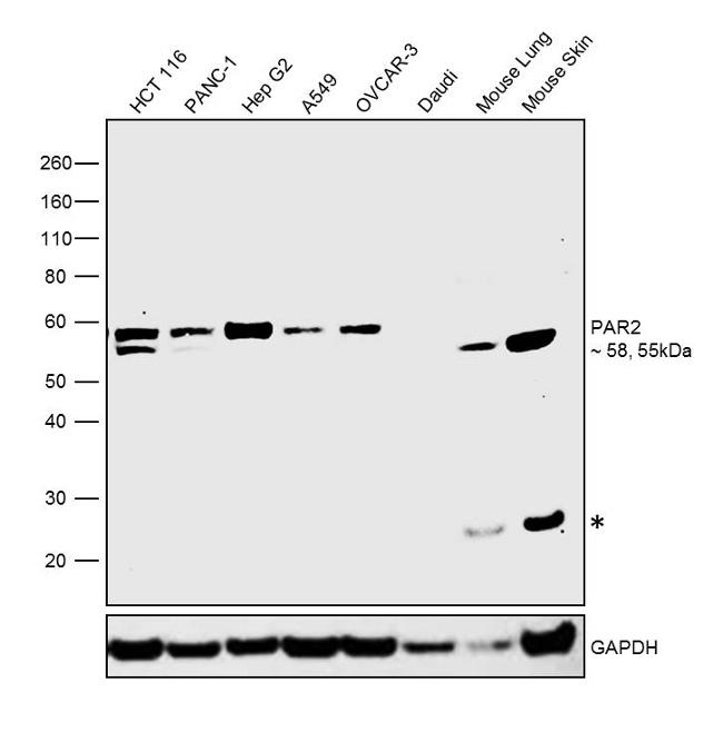 PAR2 Antibody in Western Blot (WB)