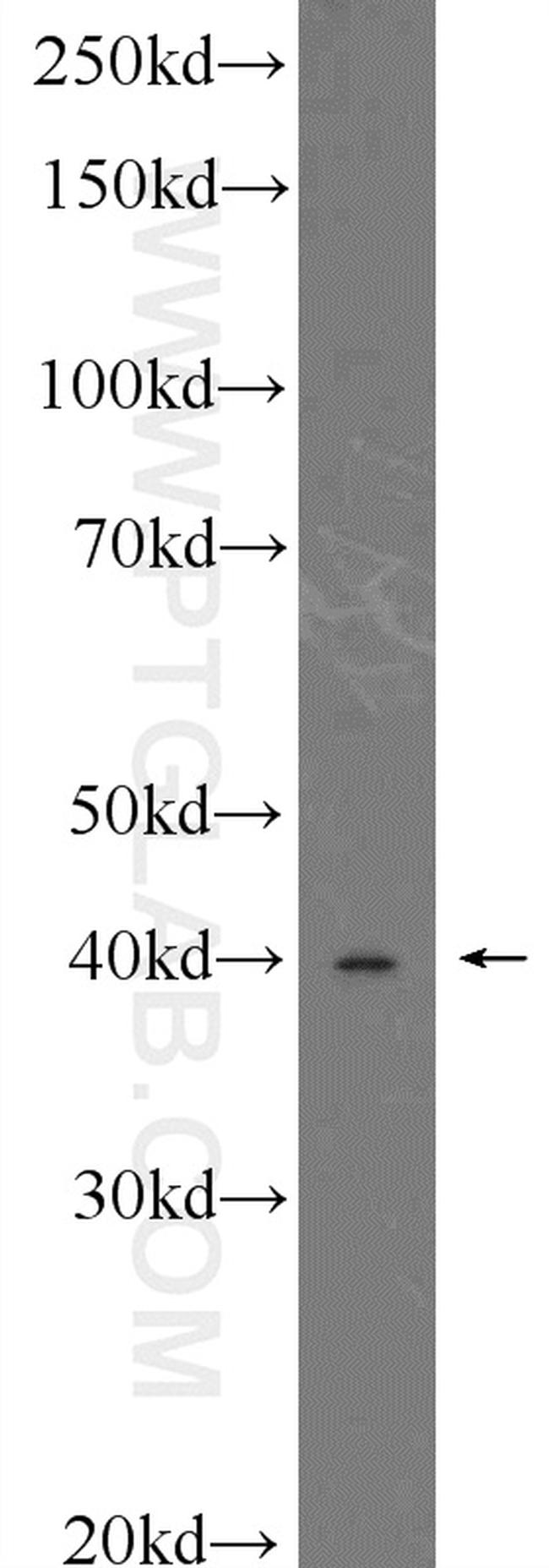 LEF1 Antibody in Western Blot (WB)