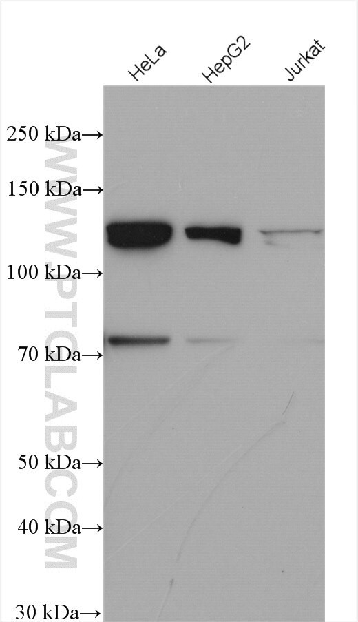 MTMR14 Antibody in Western Blot (WB)