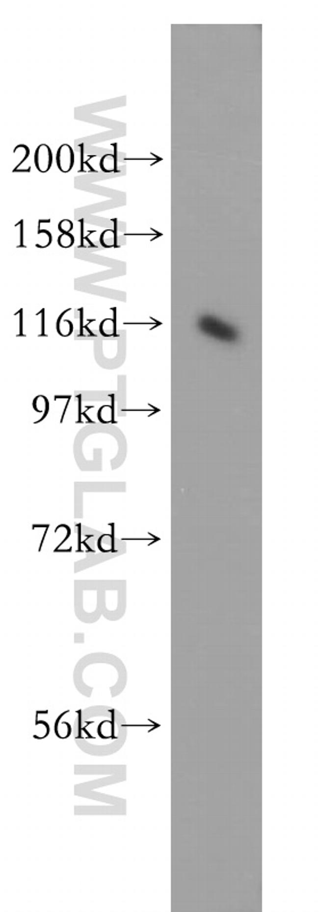 MTMR14 Antibody in Western Blot (WB)