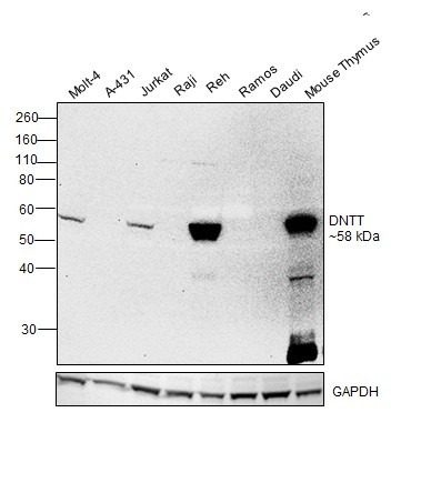 TdT Antibody