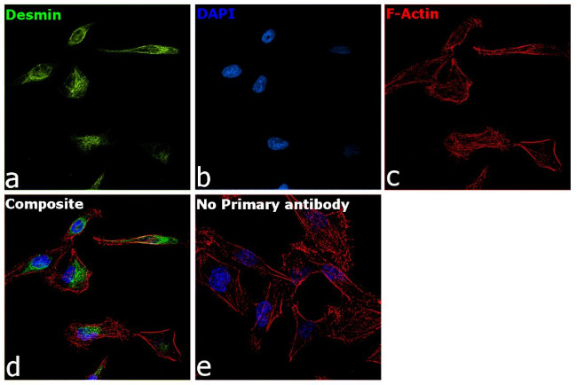 Desmin Antibody in Immunocytochemistry (ICC/IF)