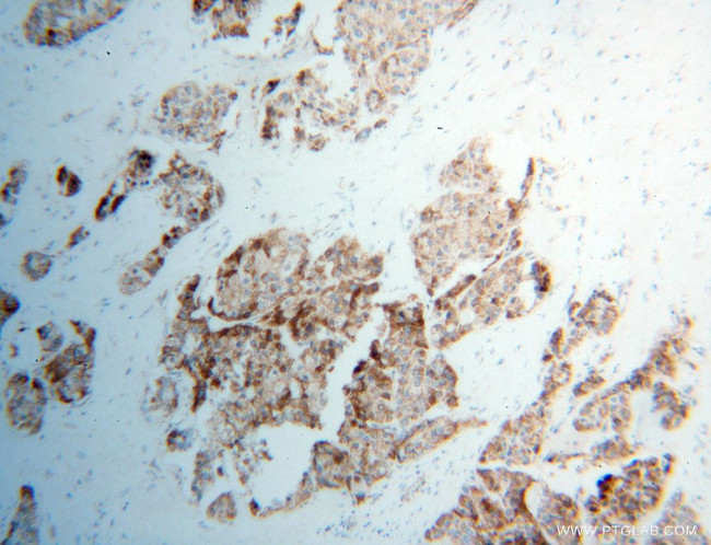 UQCRQ Antibody in Immunohistochemistry (Paraffin) (IHC (P))