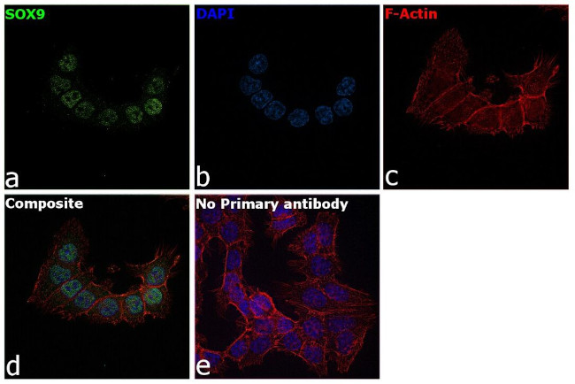 SOX9 Antibody in Immunocytochemistry (ICC/IF)