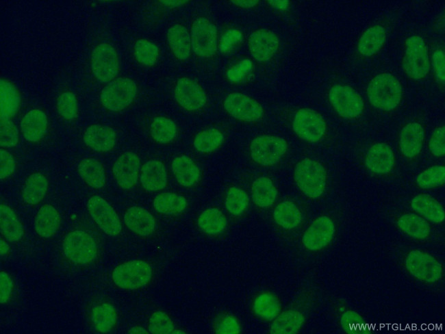 SNRPF Antibody in Immunocytochemistry (ICC/IF)