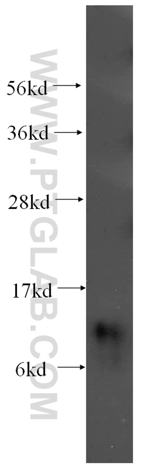 SNRPF Antibody in Western Blot (WB)