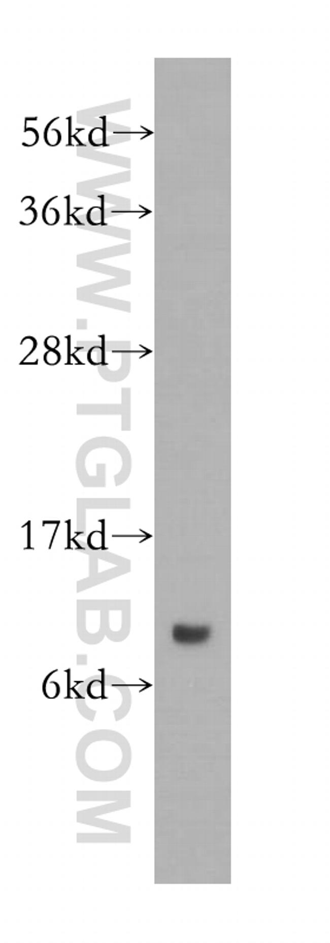 SNRPF Antibody in Western Blot (WB)