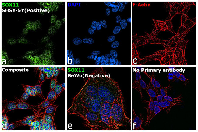 SOX11 Antibody