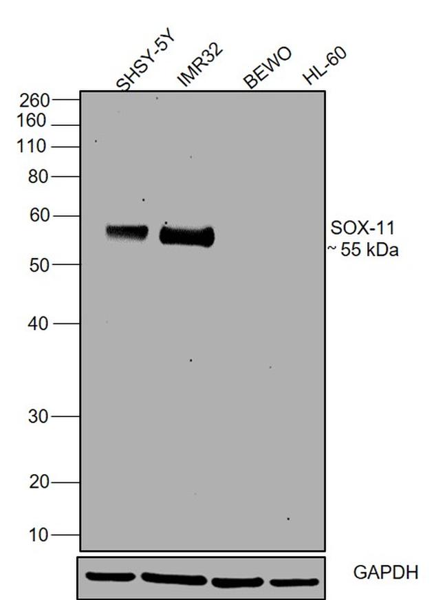 SOX11 Antibody in Western Blot (WB)