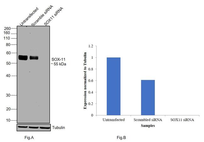 SOX11 Antibody in Western Blot (WB)