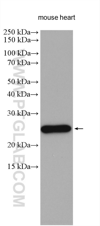 AK1 Antibody in Western Blot (WB)