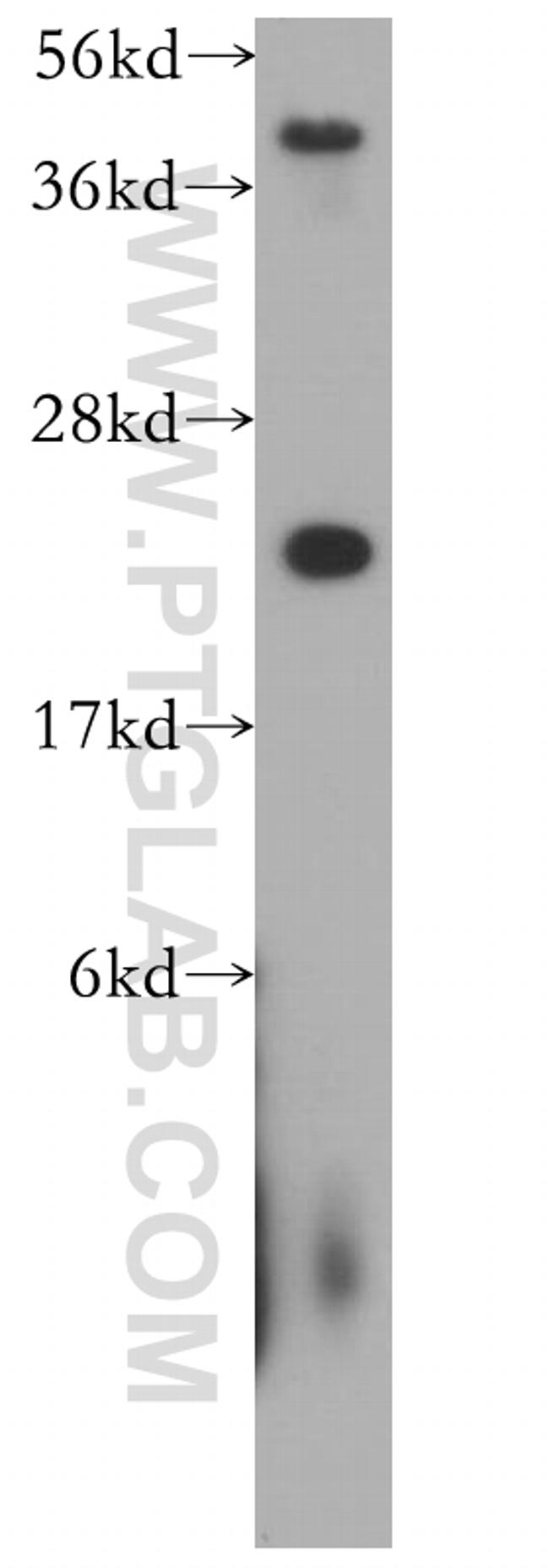 AK1 Antibody in Western Blot (WB)