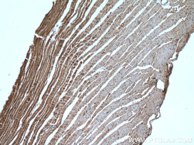 AK1 Antibody in Immunohistochemistry (Paraffin) (IHC (P))