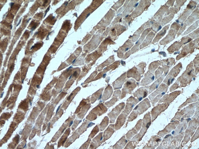 AK1 Antibody in Immunohistochemistry (Paraffin) (IHC (P))