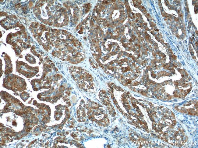 Galectin-3 Antibody in Immunohistochemistry (Paraffin) (IHC (P))