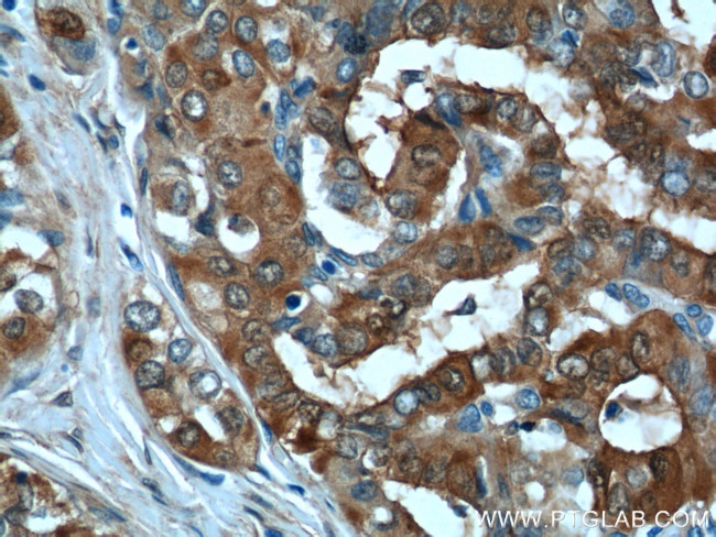 Galectin-3 Antibody in Immunohistochemistry (Paraffin) (IHC (P))