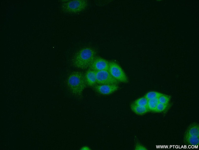 Galectin-3 Antibody in Immunocytochemistry (ICC/IF)