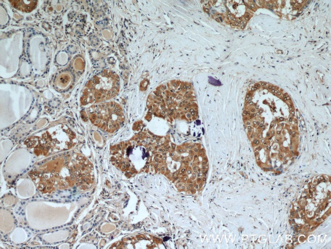 Galectin-3 Antibody in Immunohistochemistry (Paraffin) (IHC (P))