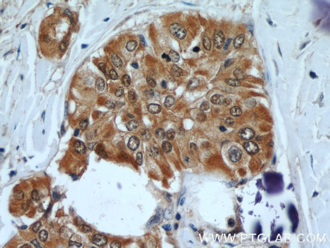 Galectin-3 Antibody in Immunohistochemistry (Paraffin) (IHC (P))