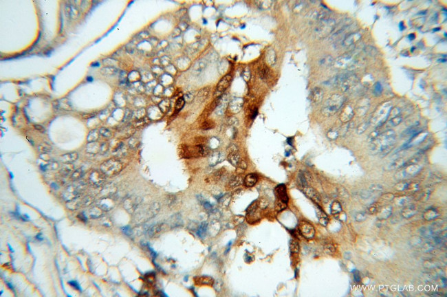 Galectin-3 Antibody in Immunohistochemistry (Paraffin) (IHC (P))