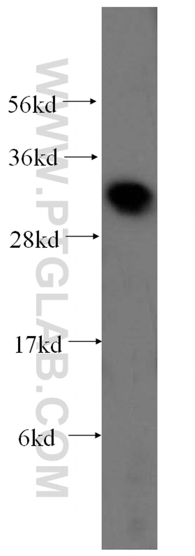 Galectin-3 Antibody in Western Blot (WB)