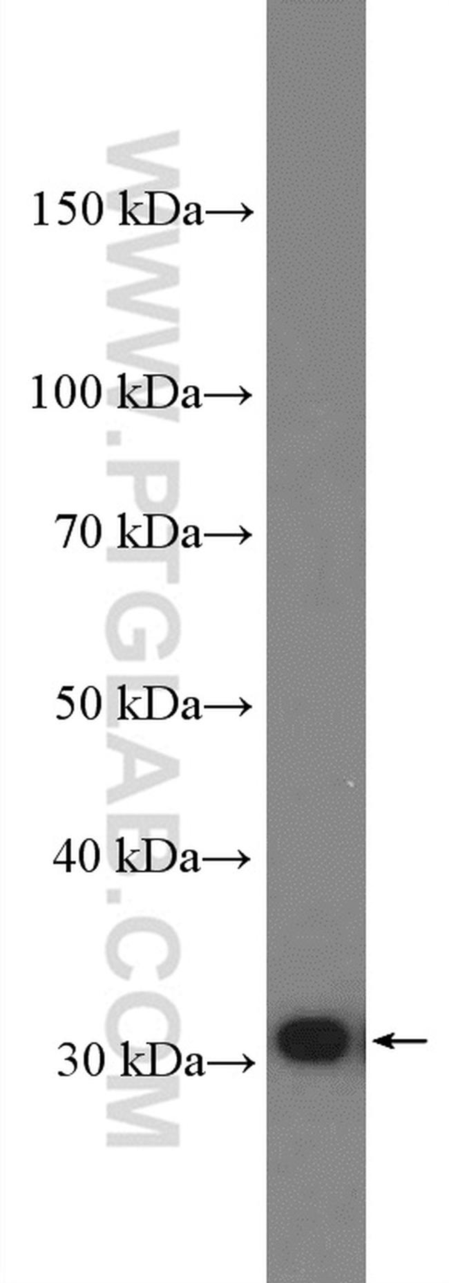 Galectin-3 Antibody in Western Blot (WB)