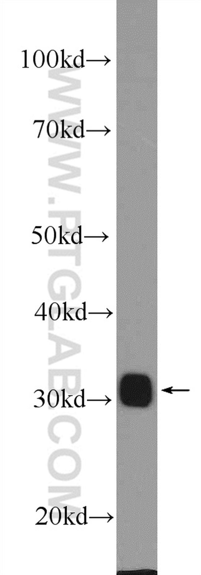 Galectin-3 Antibody in Western Blot (WB)