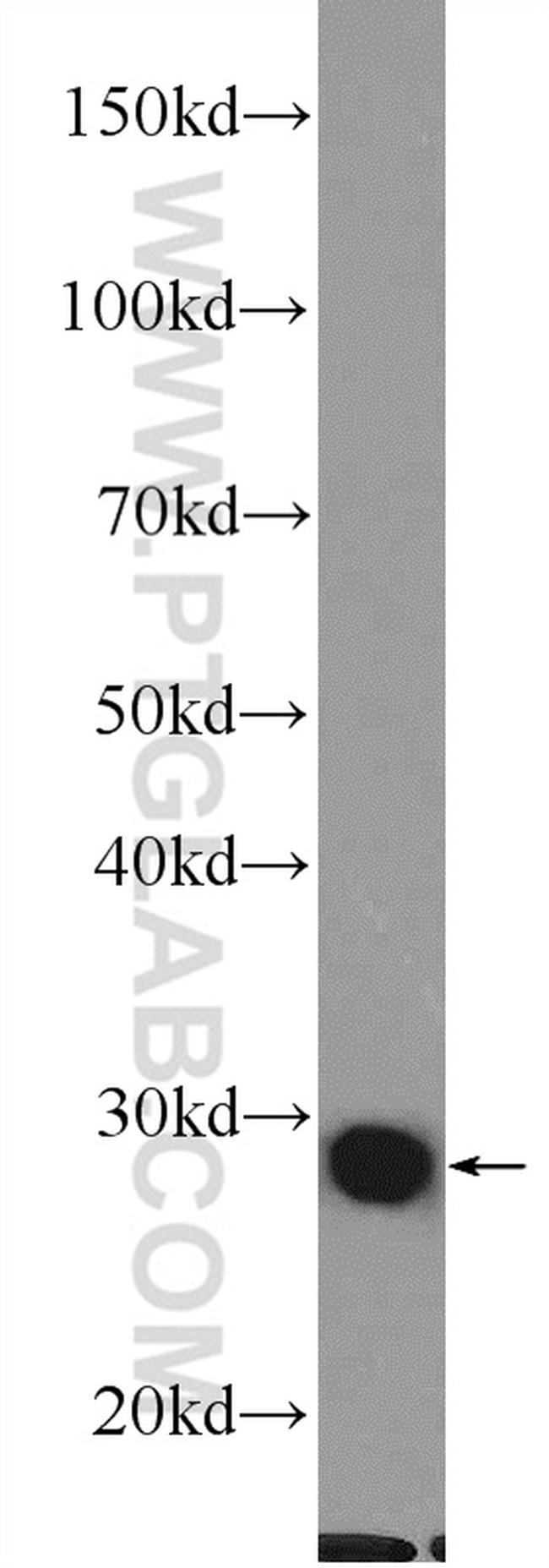 Galectin-3 Antibody in Western Blot (WB)