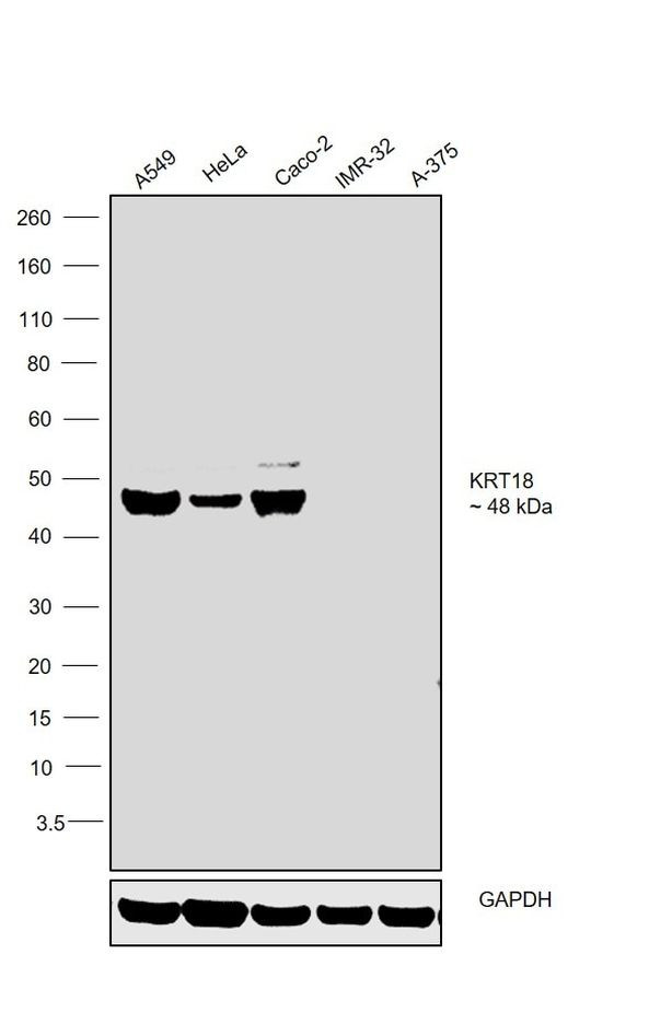 Cytokeratin 18 Antibody