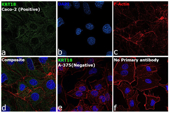 Cytokeratin 18 Antibody in Immunocytochemistry (ICC/IF)