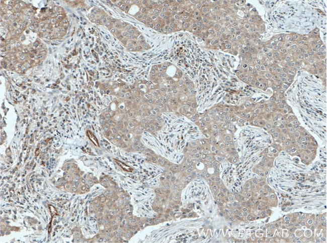 PPA1 Antibody in Immunohistochemistry (Paraffin) (IHC (P))