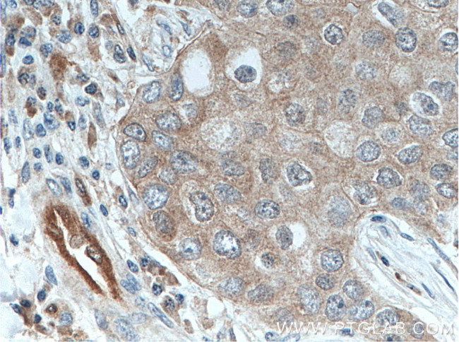 PPA1 Antibody in Immunohistochemistry (Paraffin) (IHC (P))