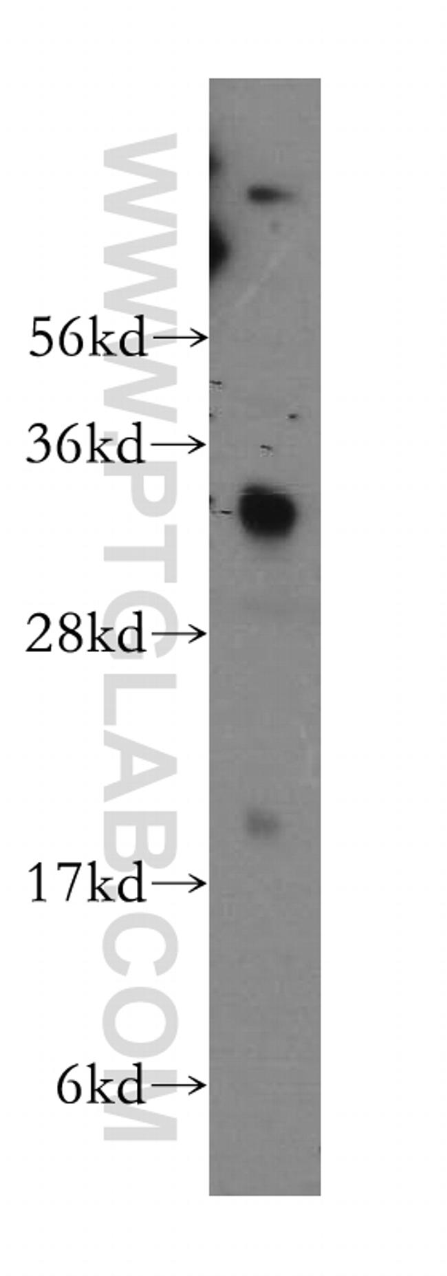 PPA1 Antibody in Western Blot (WB)