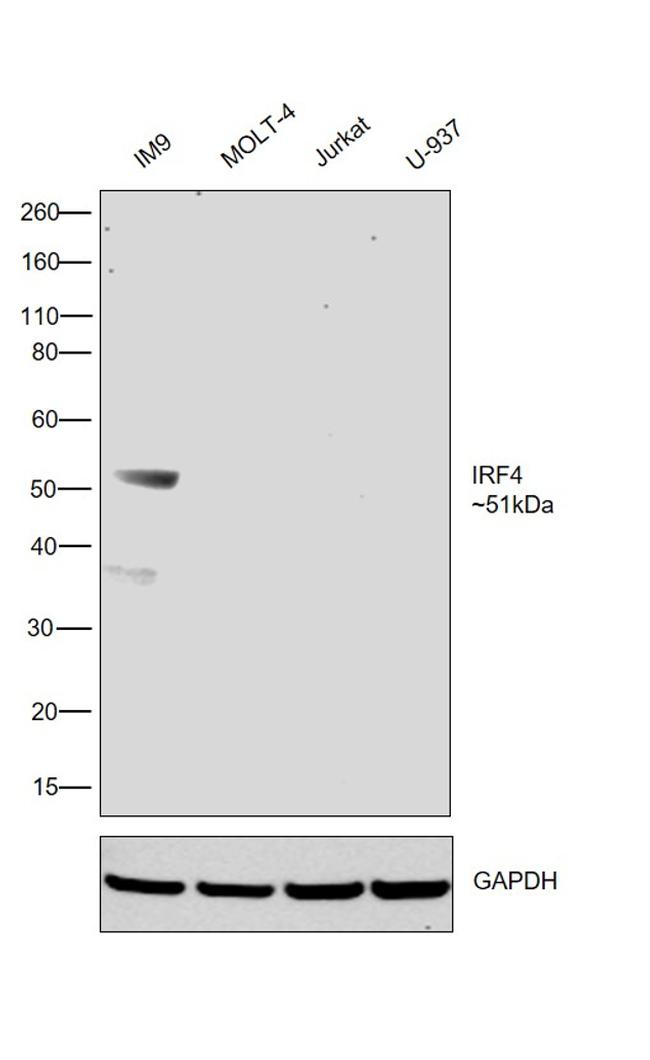 IRF4 Antibody in Western Blot (WB)