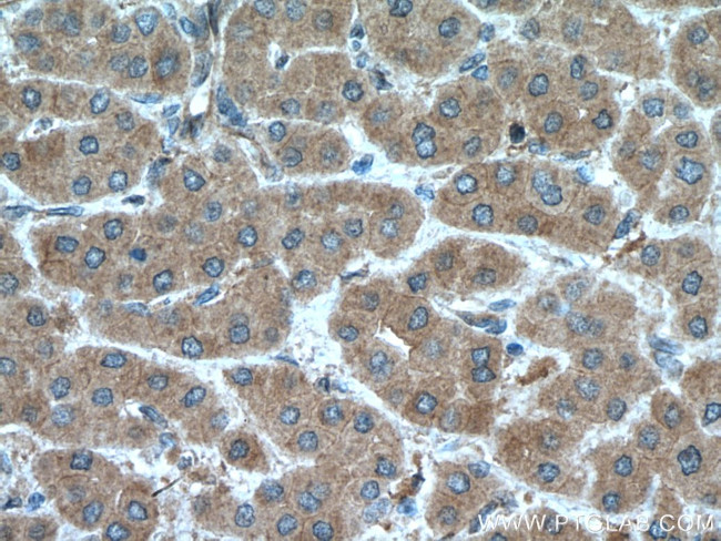 MGLL Antibody in Immunohistochemistry (Paraffin) (IHC (P))