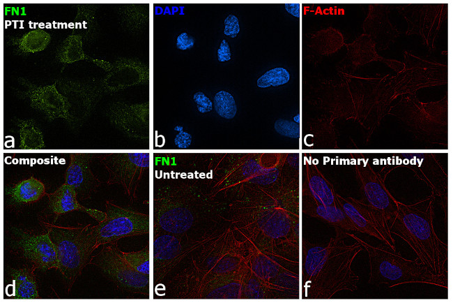 Fibronectin Antibody in Immunocytochemistry (ICC/IF)