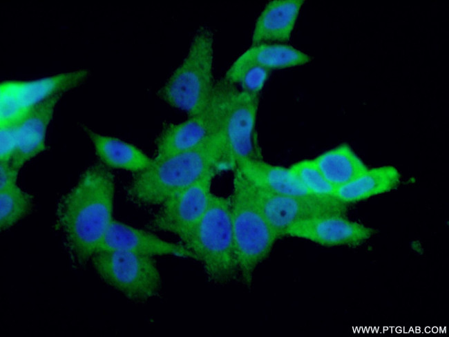 S100A13 Antibody in Immunocytochemistry (ICC/IF)