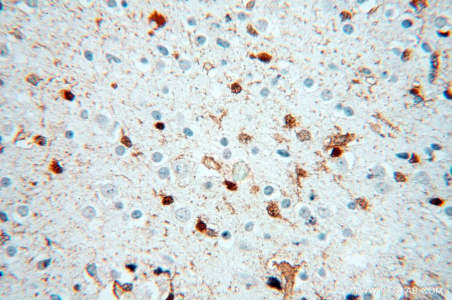 S100A13 Antibody in Immunohistochemistry (Paraffin) (IHC (P))