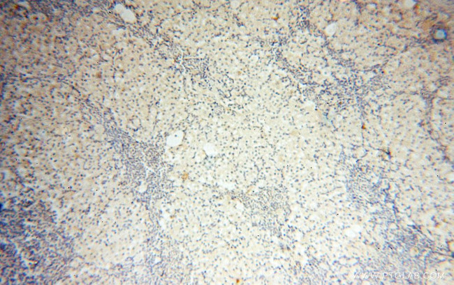 S100A13 Antibody in Immunohistochemistry (Paraffin) (IHC (P))