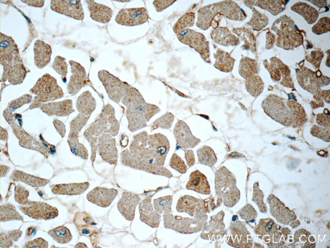 S100A13 Antibody in Immunohistochemistry (Paraffin) (IHC (P))