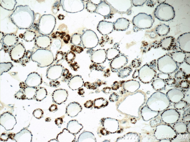 S100A13 Antibody in Immunohistochemistry (Paraffin) (IHC (P))