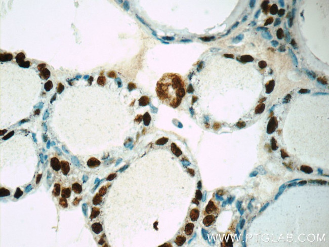 S100A13 Antibody in Immunohistochemistry (Paraffin) (IHC (P))