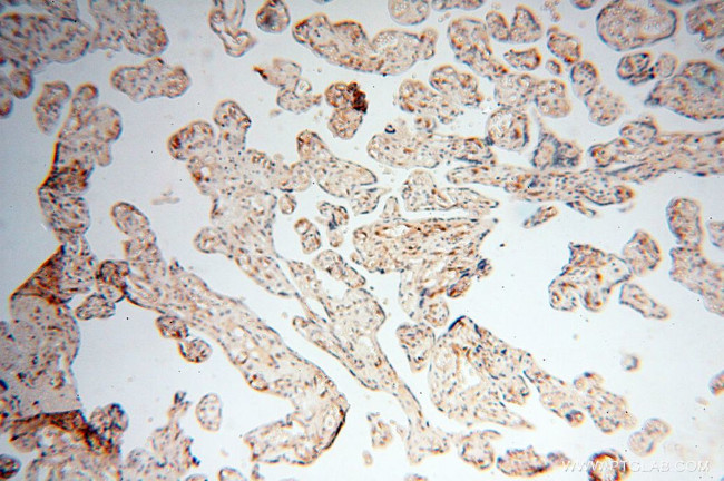 S100A13 Antibody in Immunohistochemistry (Paraffin) (IHC (P))