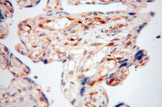 S100A13 Antibody in Immunohistochemistry (Paraffin) (IHC (P))