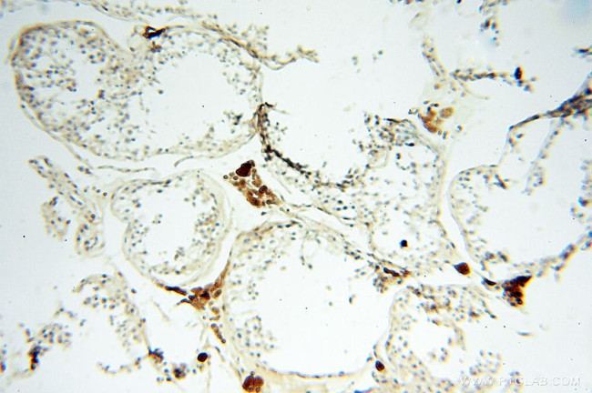 S100A13 Antibody in Immunohistochemistry (Paraffin) (IHC (P))