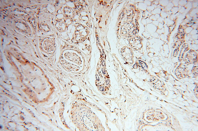 S100A13 Antibody in Immunohistochemistry (Paraffin) (IHC (P))