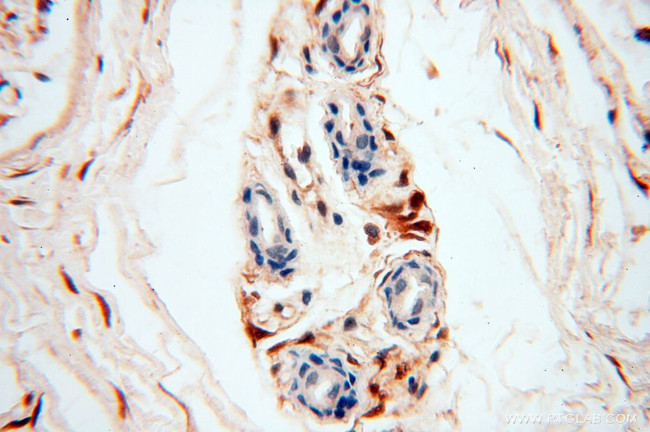 S100A13 Antibody in Immunohistochemistry (Paraffin) (IHC (P))