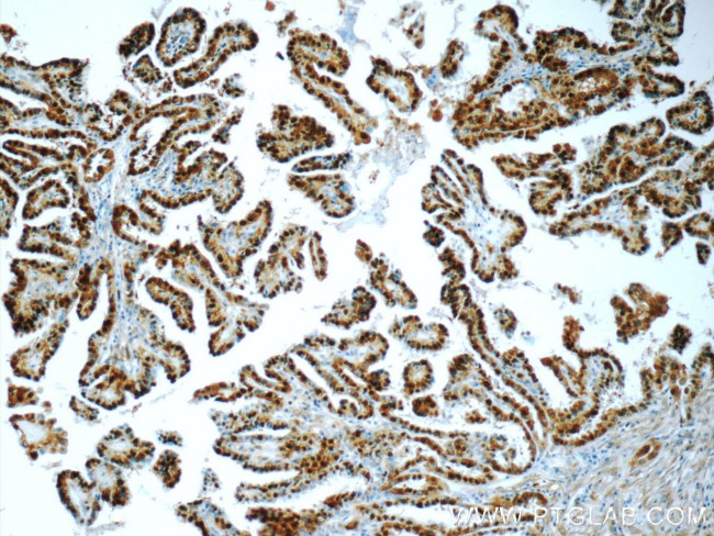 S100A13 Antibody in Immunohistochemistry (Paraffin) (IHC (P))